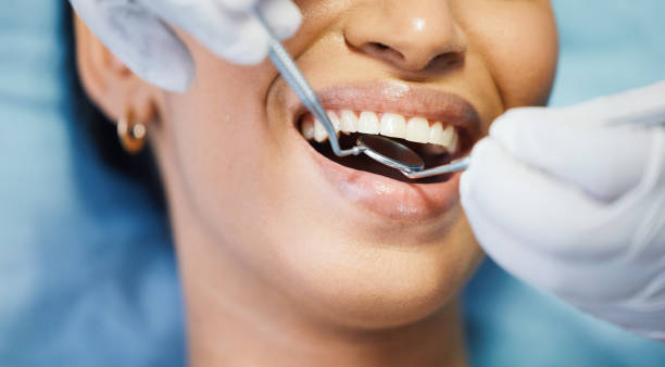 Best Emergency Treatment for Dental Infections or Abscesses in Boca Raton, FL